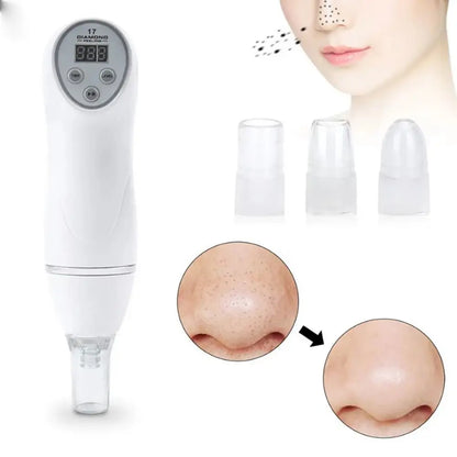 Limpiador facial Microdermoabrasion puntas de diam.